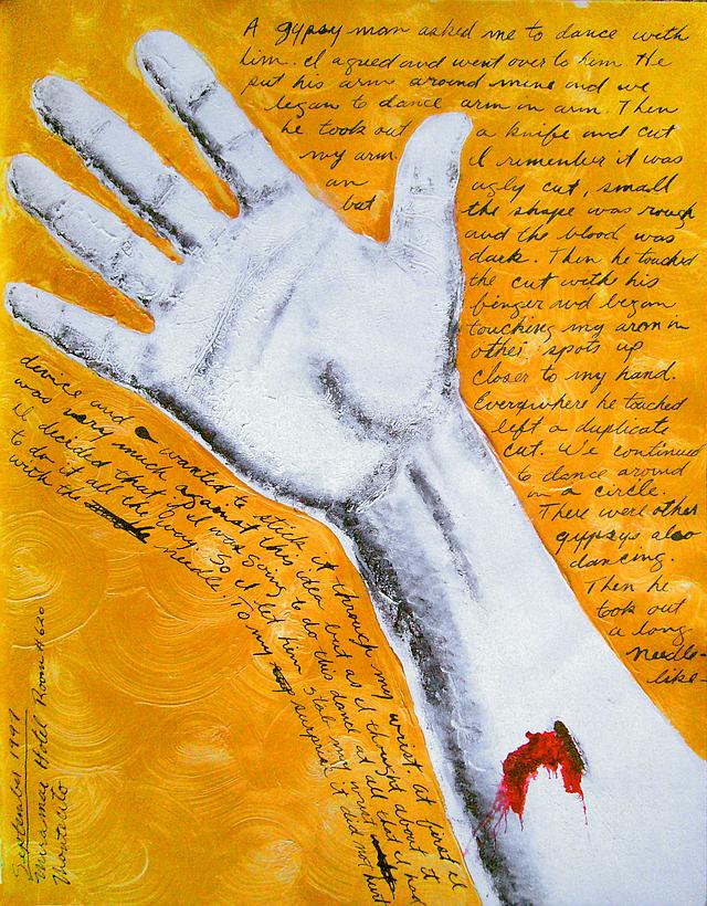 Hand and forearm with bleeding hole; dream painting by Larry Vigon.