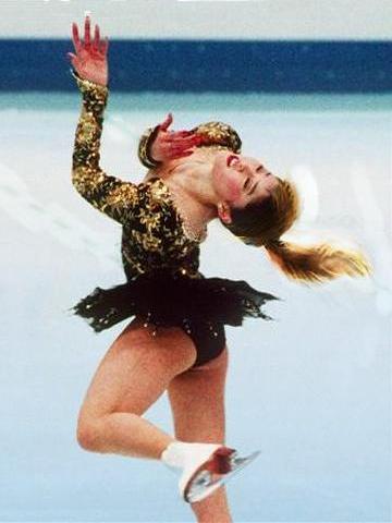 Olympic skater Kristi Yamaguchi with hair dyed blonde as seen in a dream by Wayan.