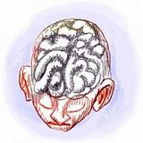 Cartoon of a brain, by Wayan. Click to enlarge.
